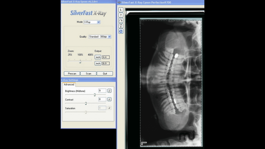 SilverFast X-RAY (medical scanner software) preview